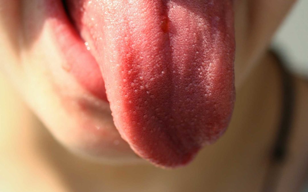 Die belegte Zunge